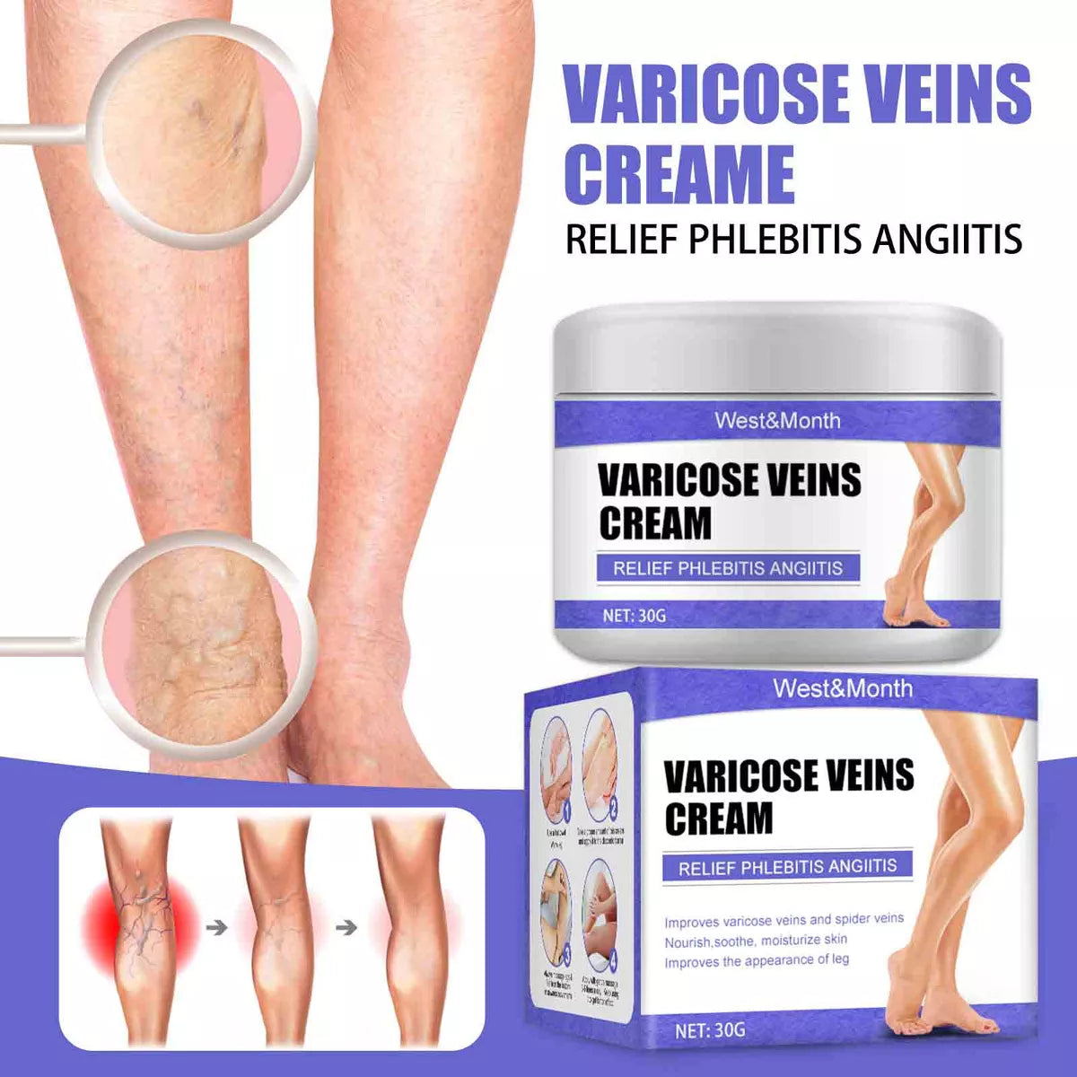 CREMA PARA VARICES PIERNAS PERFECTAS